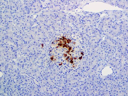 IHC of Somatostatin on an FFPE Pancreas Tissue